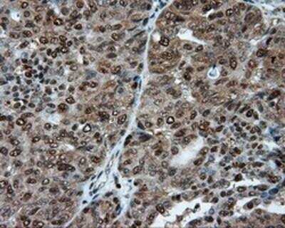 Immunohistochemistry-Paraffin: ATP Citrate Lyase Antibody (OTI3G8) [NBP2-02410]
