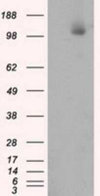 Western Blot: ATP Citrate Lyase Antibody (OTI3G8) [NBP2-02410]