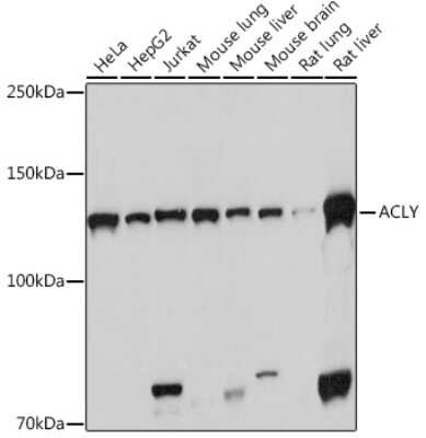 Western Blot: ATP Citrate Lyase Antibody (8A0V0) [NBP3-16261]