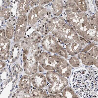 Immunohistochemistry-Paraffin: ATP Citrate Lyase Antibody [NBP1-90268]