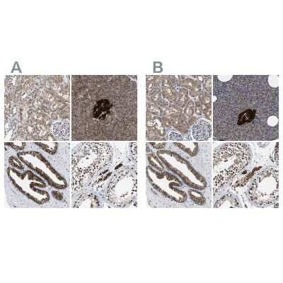 Immunohistochemistry-Paraffin: ATP Citrate Lyase Antibody [NBP1-90268]