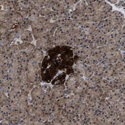 Immunohistochemistry-Paraffin: ATP Citrate Lyase Antibody [NBP1-90268]