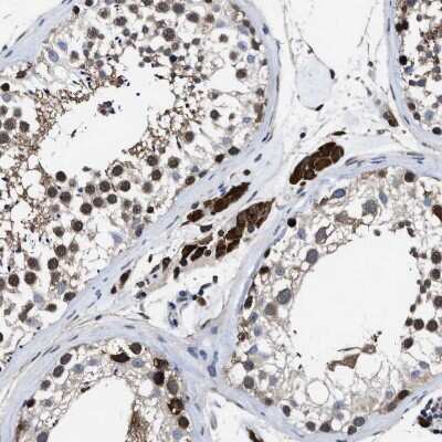 Immunohistochemistry-Paraffin: ATP Citrate Lyase Antibody [NBP1-90268]