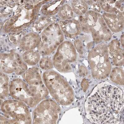Immunohistochemistry-Paraffin: ATP Citrate Lyase Antibody [NBP1-90269]