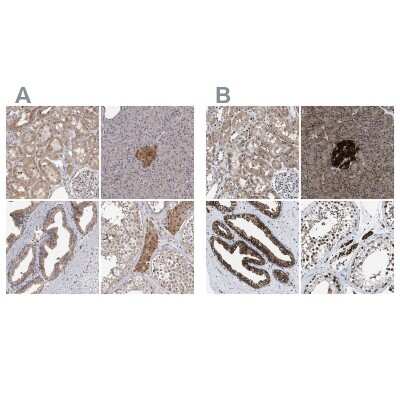 Immunohistochemistry-Paraffin: ATP Citrate Lyase Antibody [NBP1-90269]
