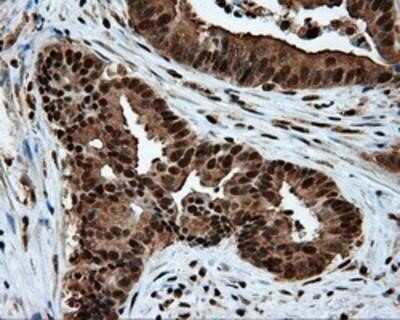 Immunohistochemistry: ATP Citrate Lyase Antibody (OTI3G8) - Azide and BSA Free [NBP2-70073]