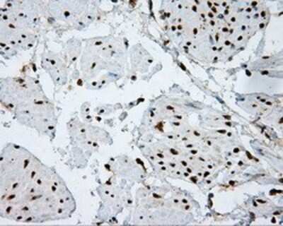 Immunohistochemistry: ATP Citrate Lyase Antibody (OTI3G8) - Azide and BSA Free [NBP2-70073]