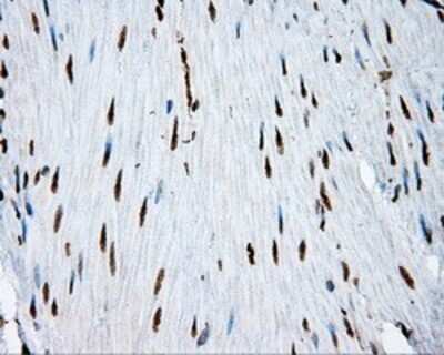Immunohistochemistry: ATP Citrate Lyase Antibody (OTI3G8) - Azide and BSA Free [NBP2-70073]