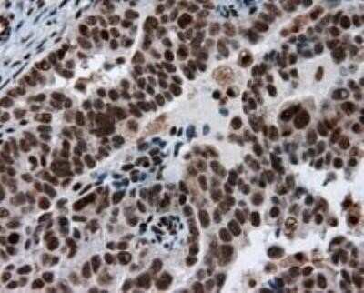 Immunohistochemistry: ATP Citrate Lyase Antibody (OTI3G8) - Azide and BSA Free [NBP2-70073]