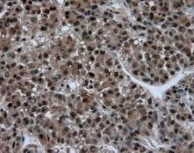Immunohistochemistry: ATP Citrate Lyase Antibody (OTI3G8) - Azide and BSA Free [NBP2-70073]