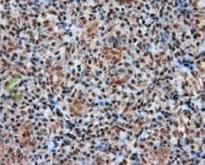 Immunohistochemistry: ATP Citrate Lyase Antibody (OTI3G8) - Azide and BSA Free [NBP2-70073]