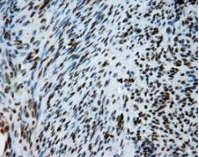 Immunohistochemistry: ATP Citrate Lyase Antibody (OTI3G8) - Azide and BSA Free [NBP2-70073]