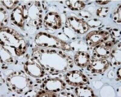Immunohistochemistry: ATP Citrate Lyase Antibody (OTI3G8) - Azide and BSA Free [NBP2-70073]
