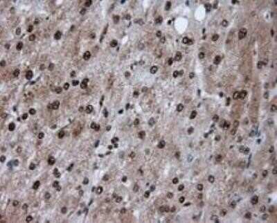 Immunohistochemistry: ATP Citrate Lyase Antibody (OTI3G8) - Azide and BSA Free [NBP2-70073]