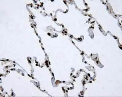 Immunohistochemistry: ATP Citrate Lyase Antibody (OTI3G8) - Azide and BSA Free [NBP2-70073]