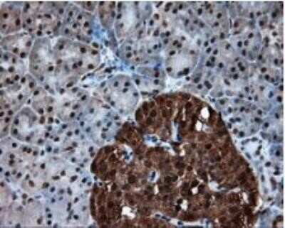 Immunohistochemistry: ATP Citrate Lyase Antibody (OTI3G8) - Azide and BSA Free [NBP2-70073]