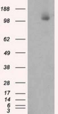 Western Blot: ATP Citrate Lyase Antibody (OTI3G8)Azide and BSA Free [NBP2-70073]