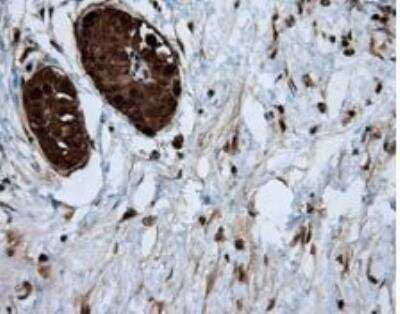 Immunohistochemistry-Paraffin: ATP Citrate Lyase Antibody (OTI3G8) [NBP2-02410]