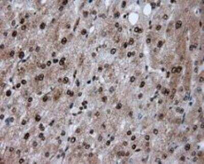 Immunohistochemistry-Paraffin: ATP Citrate Lyase Antibody (OTI3G8) [NBP2-02410]