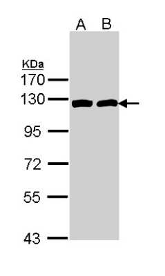 Western Blot: ATP Citrate Lyase Antibody [NBP1-33430]