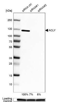 Western Blot: ATP Citrate Lyase Antibody [NBP1-90266]