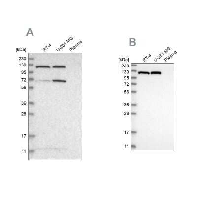 Western Blot: ATP Citrate Lyase Antibody [NBP1-90267]