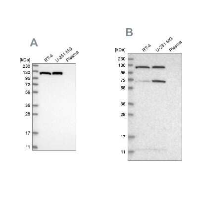 Western Blot: ATP Citrate Lyase Antibody [NBP1-90268]