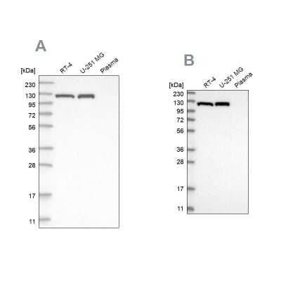 Western Blot: ATP Citrate Lyase Antibody [NBP1-90269]