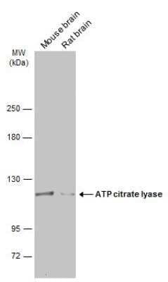 Western Blot: ATP Citrate Lyase Antibody [NBP2-15510]