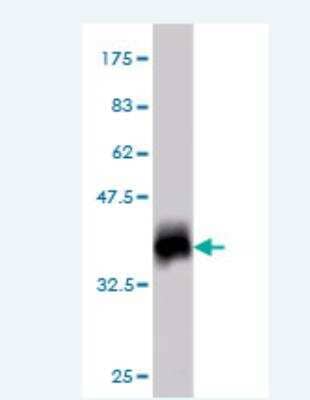 Western Blot: ATP synthase C mature Antibody (1A12) [H00000516-M01]