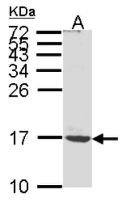 Western Blot: ATP synthase C mature Antibody [NBP1-31242]