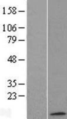 Western Blot: ATP synthase C mature Overexpression Lysate [NBL1-07823]