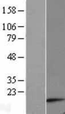 Western Blot: ATP synthase C mature Overexpression Lysate [NBP2-11312]