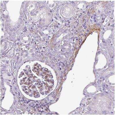 Immunohistochemistry: ATP10A Antibody [NBP2-30505]