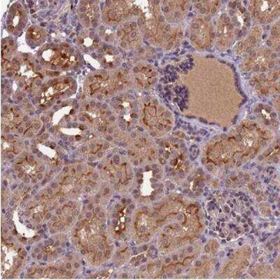 Immunohistochemistry: ATP10A Antibody [NBP2-30807]