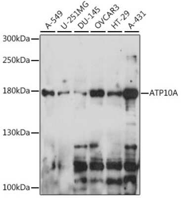 Western Blot: ATP10A AntibodyAzide and BSA Free [NBP2-92270]