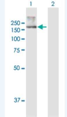 Western Blot: ATP10B Antibody [H00023120-B01P-50ug]