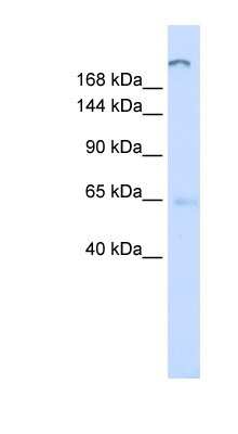 Western Blot: ATP10D Antibody [NBP1-59982]