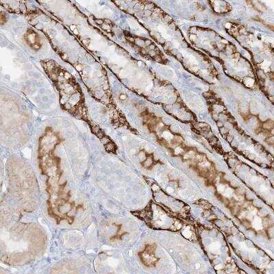 Immunohistochemistry: ATP11A Antibody [NBP1-88904]