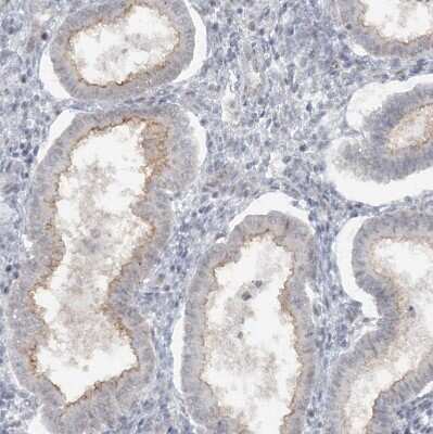 Immunohistochemistry-Paraffin: ATP11A Antibody [NBP1-88903]