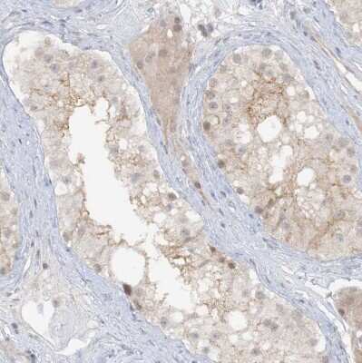 Immunohistochemistry-Paraffin: ATP11A Antibody [NBP1-88903]