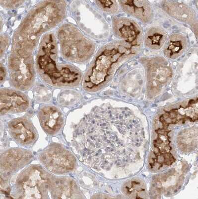 Immunohistochemistry-Paraffin: ATP11A Antibody [NBP1-88903]