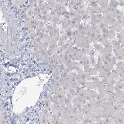 Immunohistochemistry-Paraffin: ATP11A Antibody [NBP1-88903]
