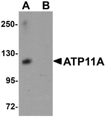 Western Blot: ATP11A AntibodyBSA Free [NBP1-77189]