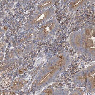 Immunohistochemistry-Paraffin: ATP11B Antibody [NBP1-88900]