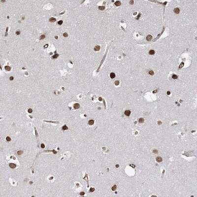 Immunohistochemistry-Paraffin: ATP11B Antibody [NBP1-88901]