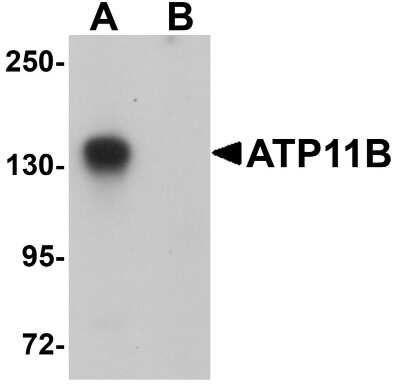 Western Blot: ATP11B AntibodyBSA Free [NBP1-77190]