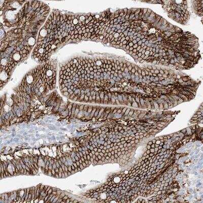 Immunohistochemistry: ATP11C Antibody [NBP1-88902]