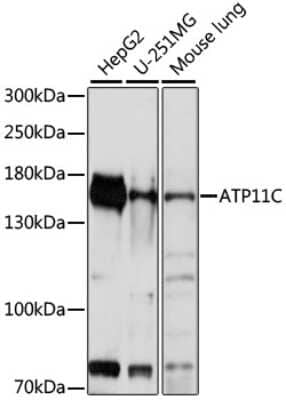 Western Blot: ATP11C AntibodyAzide and BSA Free [NBP2-92333]