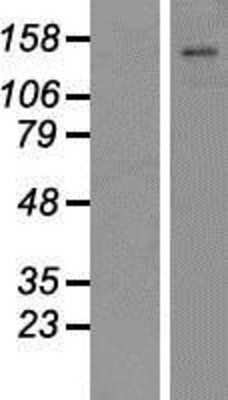 Western Blot: ATP11C Overexpression Lysate [NBP2-05133]